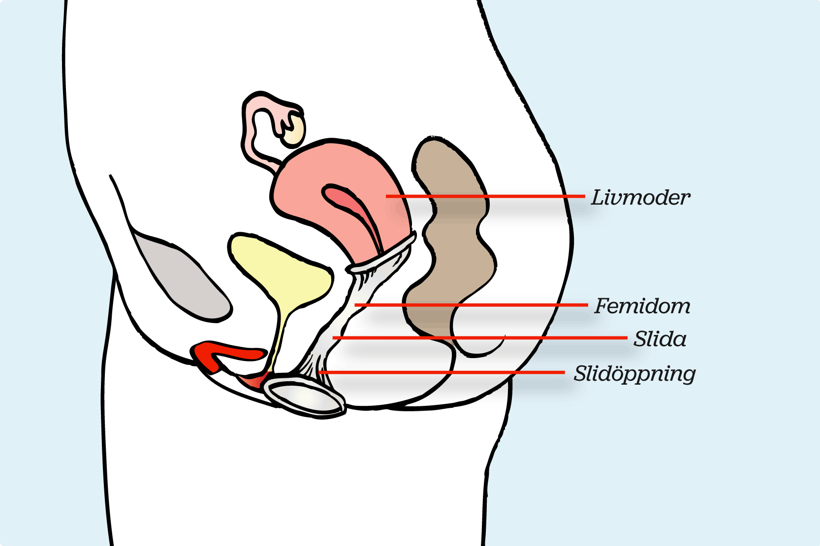 Snippan i genomskärning. Bilden visar var i slidan femidomen ska sitta. Illustration. 